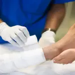 I migliori trattamenti per curare le piaghe da decubito